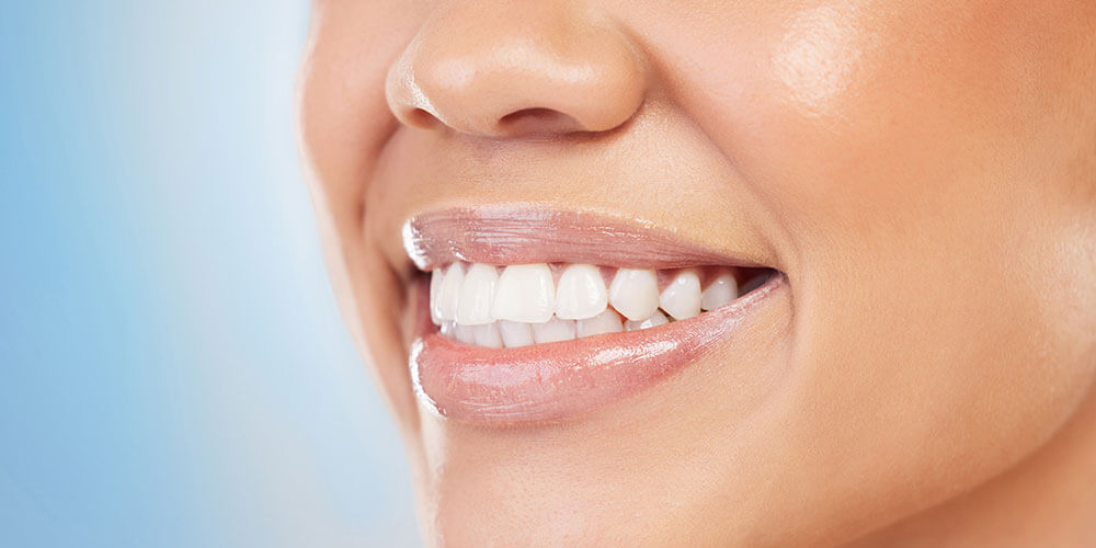 Fluoride Treatment Waterdown