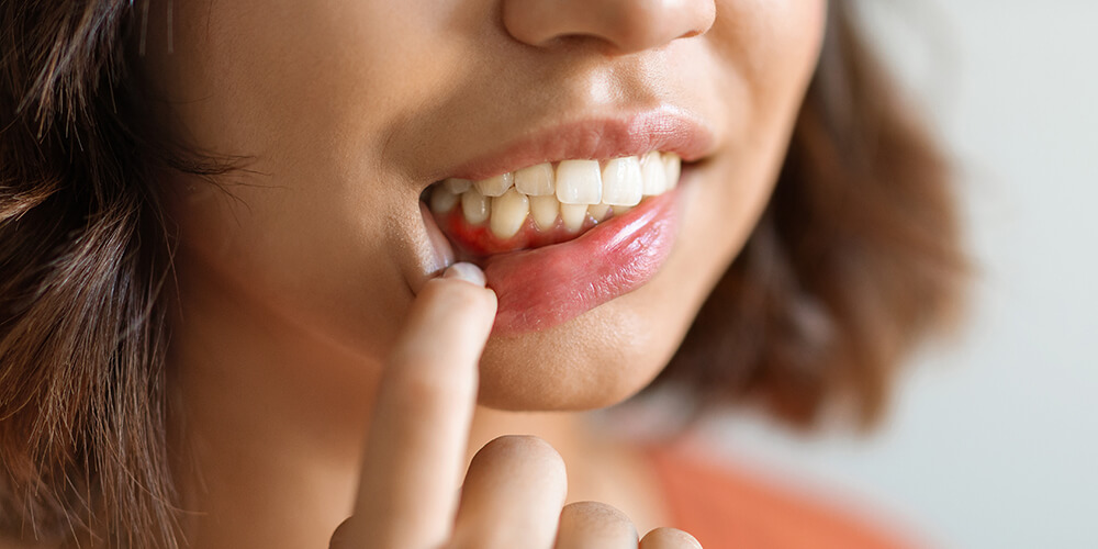 Periodontal Therapy Waterdown